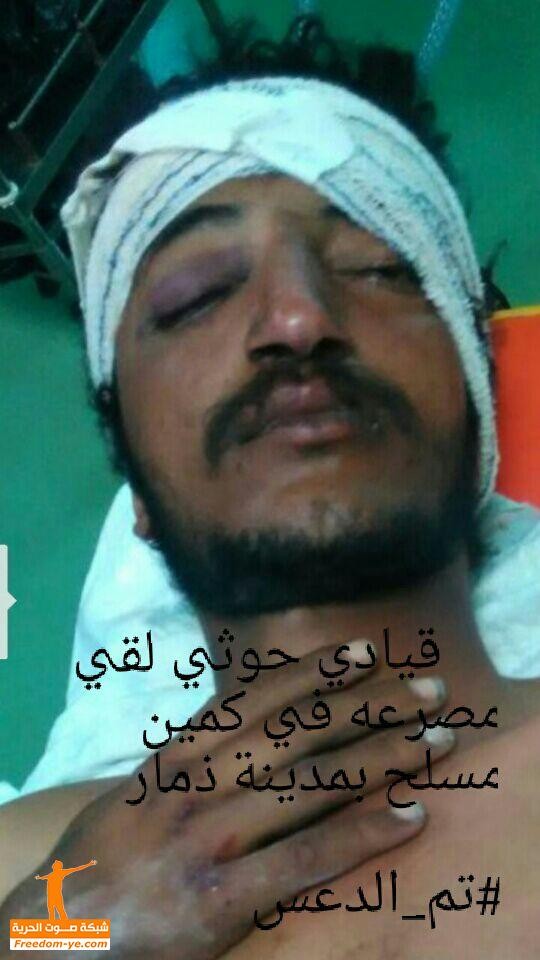 إصابة قيادي حوثي ومقتل أحد مرافقيه، في مدينة ذمار، برصاص مجهولين " صورة " 
