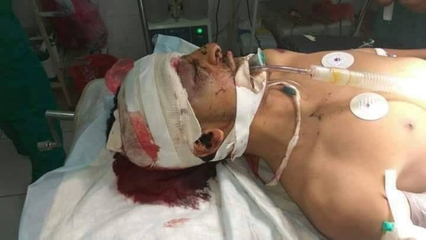 مقتل مواطن يمني يحمل الجنسية الأمريكية نتيجة إصابته برصاصة مسلح حوثي  