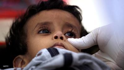 الأمم المتحدة تعلن عن أكثر من 1800 يمني قتلتهم الكوليرا