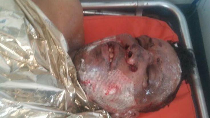 اصابة المصر الصحفي "صالح العبيدي" قرب معسكر خالد