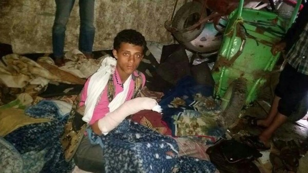  "بالصورة" الحوثيون يقطعون يد طفل في محافظة اب بالساطور