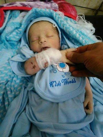 وفاة أصغر جريح في العالم اليوم في اليمن "صورة للجريح"